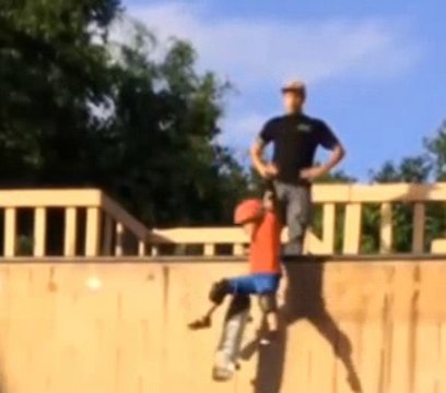 Pai quis ensinar filho a andar de skate mas teve um final desastroso