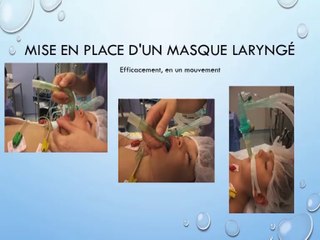 Anesthésie pédiatrique, trucs et astuces