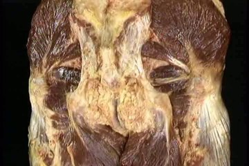 Human Anatomy thorax part 3