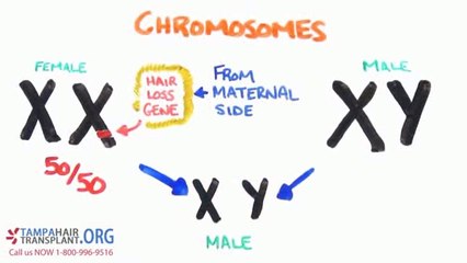 Tampa Hair Transplant - The Science of Hair Loss