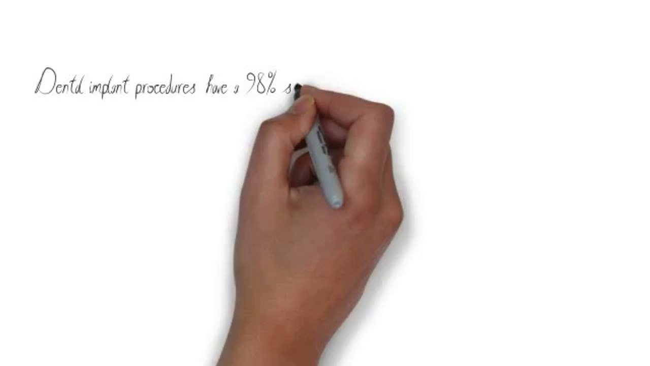 Facts about Dental Implants