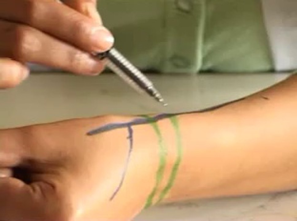 Retinaculum of Hand