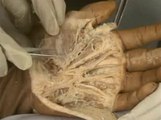 Median nerve