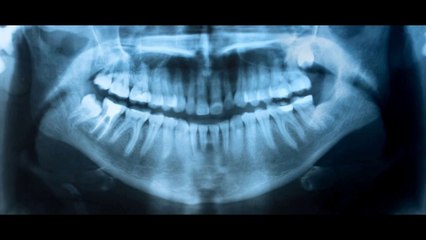 Dental Products News - The Cerec System