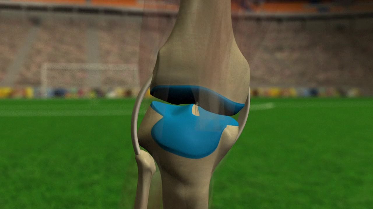 Les blessures des joueurs : le genou