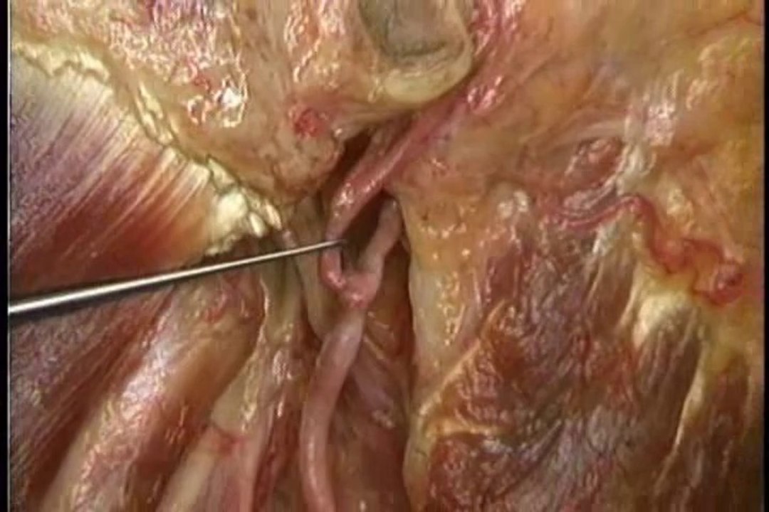 Human Anatomy Head and Neck Part 6