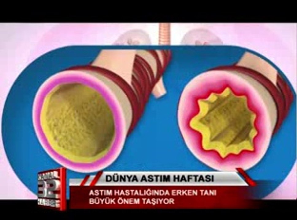 dünya astım haftası 04 21