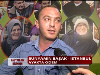 AYAKTA ÖDEM HASTALIĞI VARDI ŞİFALI BİTKİLERİ KULLANDI