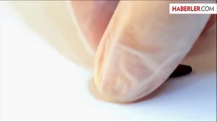 Kolanın Dişe Verdiği Zarar