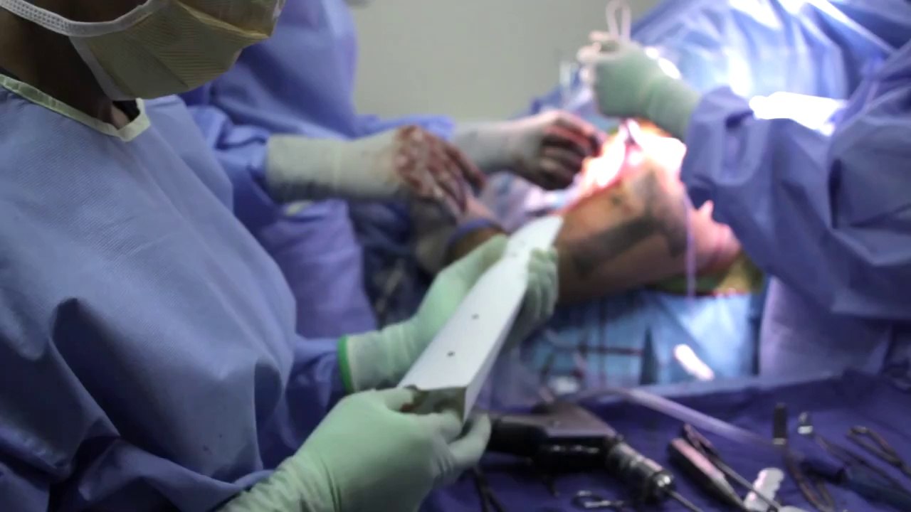 knee replacement surgery los angeles
