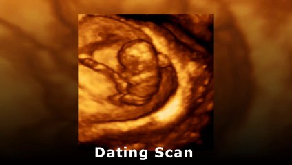 3D 4D Baby scan Oxford www.scan4d.co.uk