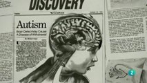Cerebro autista: Hipotesis etiologicas