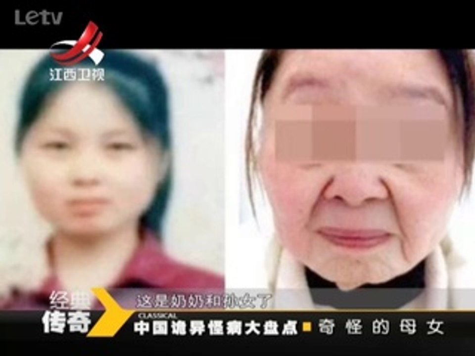《经典传奇》20140508：12岁少女老人脸的秘密 中国诡异怪病大盘点
