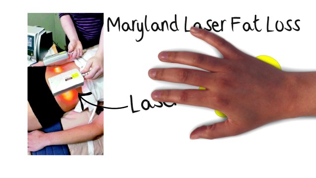 REDUCE Fat and Stretch Marks, ELIMINATE Cellulite and Lose Inches Today!