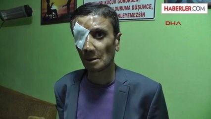 Engelliler Derneği Başkanının Otomobili Yakıldı