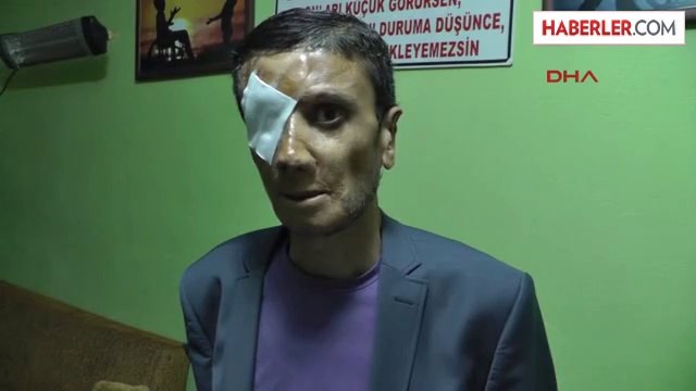 Engelliler Derneği Başkanının Otomobili Yakıldı