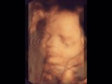 4 Boyutlu Ultrason ile Anne Karnında Bebek Resimleri