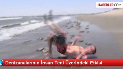 Denizanalarının İnsan Teni Üzerindeki Etkisi