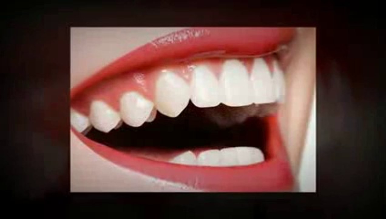 Teeth Whitening Frisco TX _ Call Today at (972) 335-7666