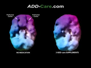 add-care-the-natural-alternative