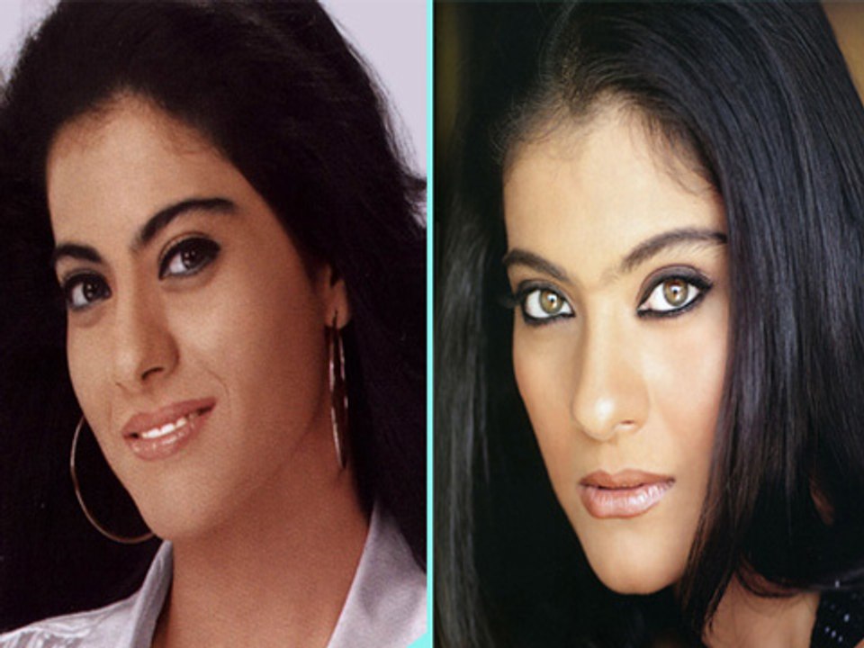 Kajol Undergoes Cosmetic Surgery