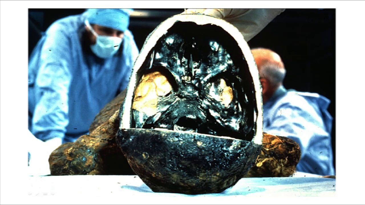 Les momies du Musée de l'Homme