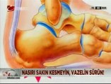 Ayaklardaki Şekil Bozuklukları- Op.Dr. Mustafa Şengün - Doç.Dr. Emel Güngör