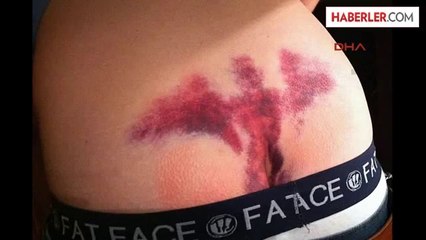 Dha Dış Haber ? Poposundaki Morluk ile Sosyal Medyanın Diline Düşdü