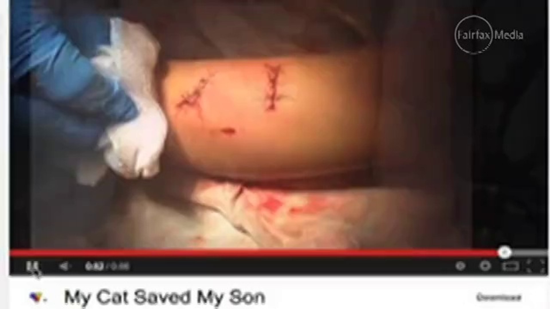⁣Pet cat saves boy from dog attack