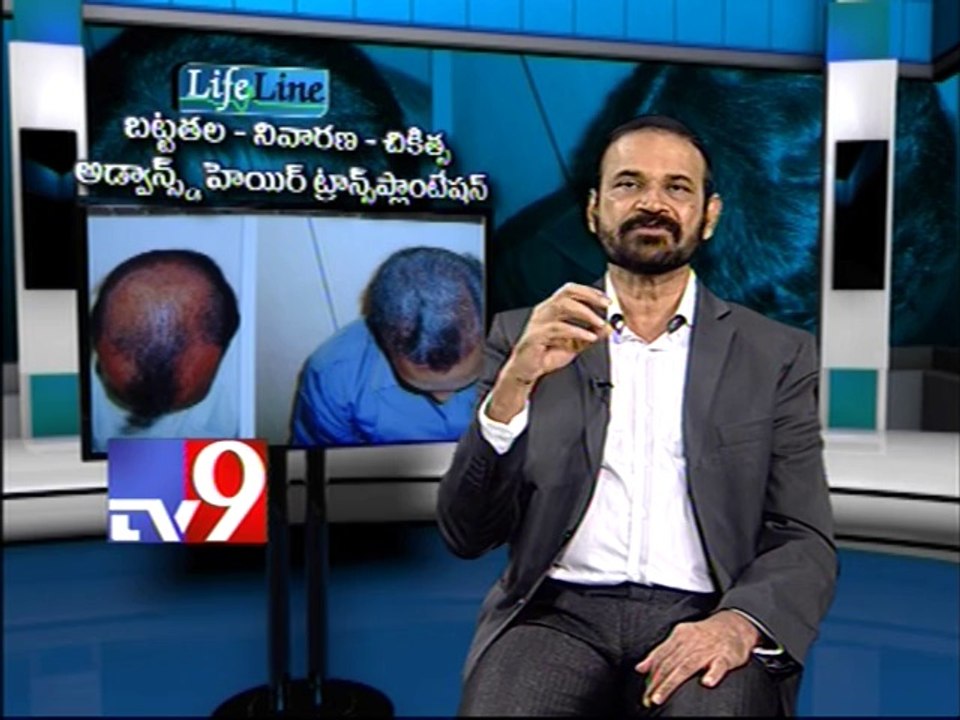Advanced hair Transplantation for Baldness