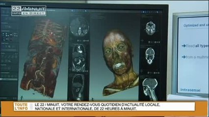 L'autopsie virtuelle au coeur d'un congrès (Marseille)