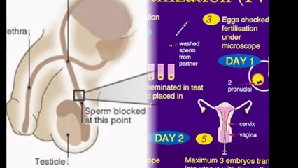 Affordable Surrogacy in india