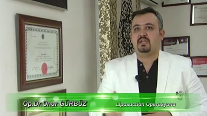 DR ONUR GURBUZ LİPOSUCTİON