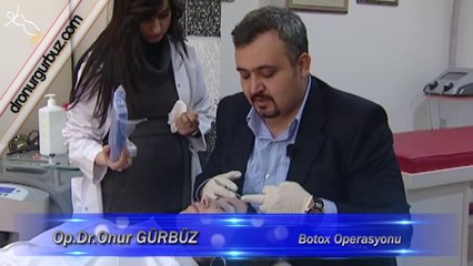 DR ONUR GURBUZ BOTOX UYGULAMASI.mpg