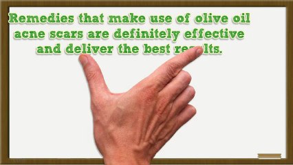 Olive Oil Acne Scars: How to Use for Treatment