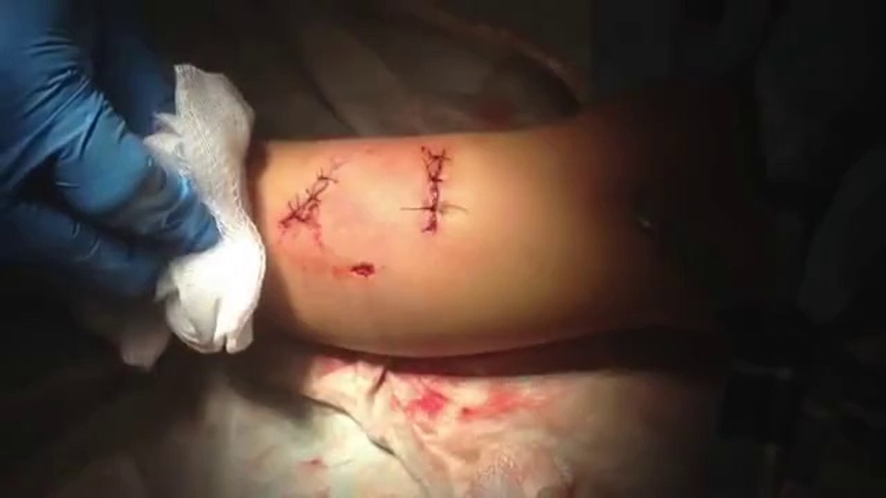 Cesur Kedi Küçük Çocuğu Köpek Saldırısından Kurtardı