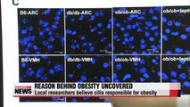 Mystery of obesity cause discovered