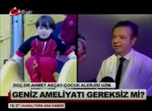 Doç.Dr.Ahmet Akçay Kanaltürk anahaber'de geniz eti ameliyatı bilgilendirmesi