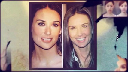 Before And After Plastic Surgery