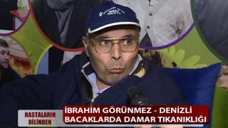 BACAKLARDA DAMAR TIKANIKLIĞI HASTALIĞI VARDI ŞİFALI BİTKİLERİ KULLANDI