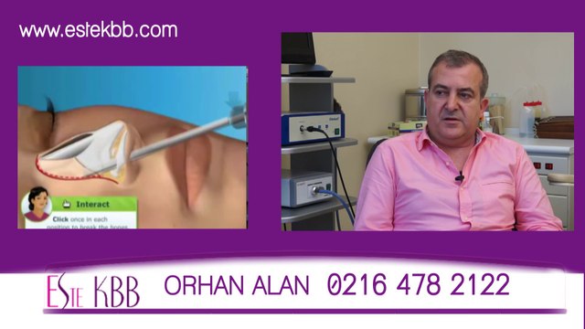 Burun estetiğinde nefes alamama