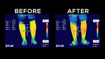 How FGXpress PowerStrips Work by Dr. Adam Saucedo