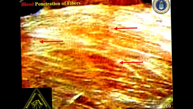 Face and Body Wounds of Jesus Christ_ The Son of Man...the LORD