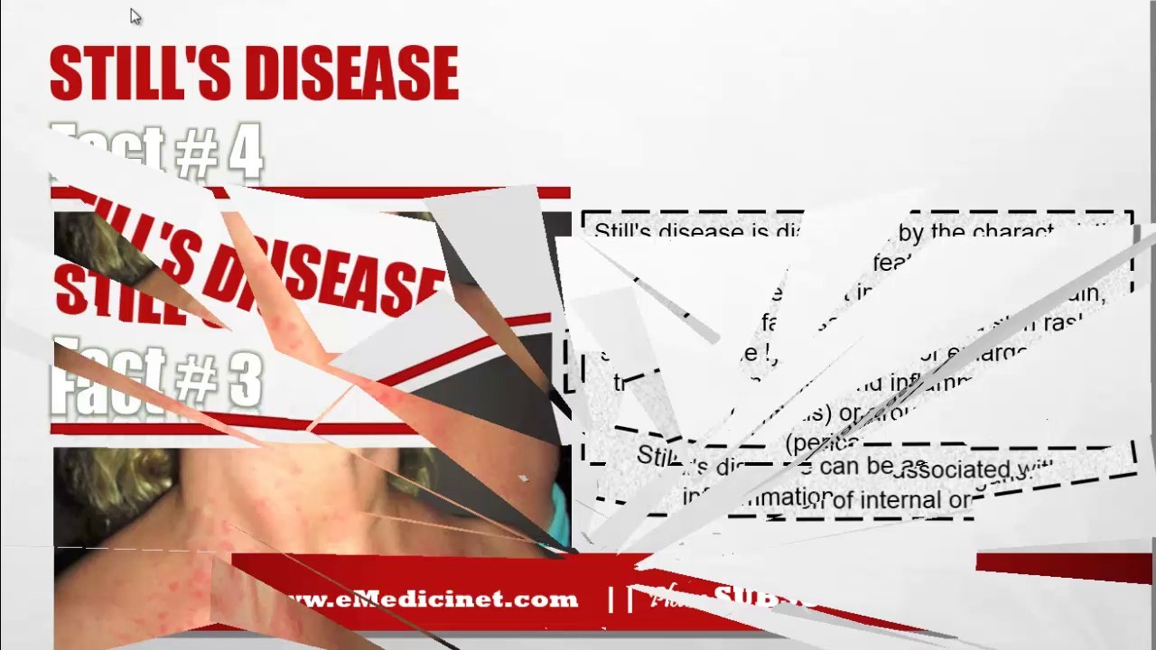 Still's disease