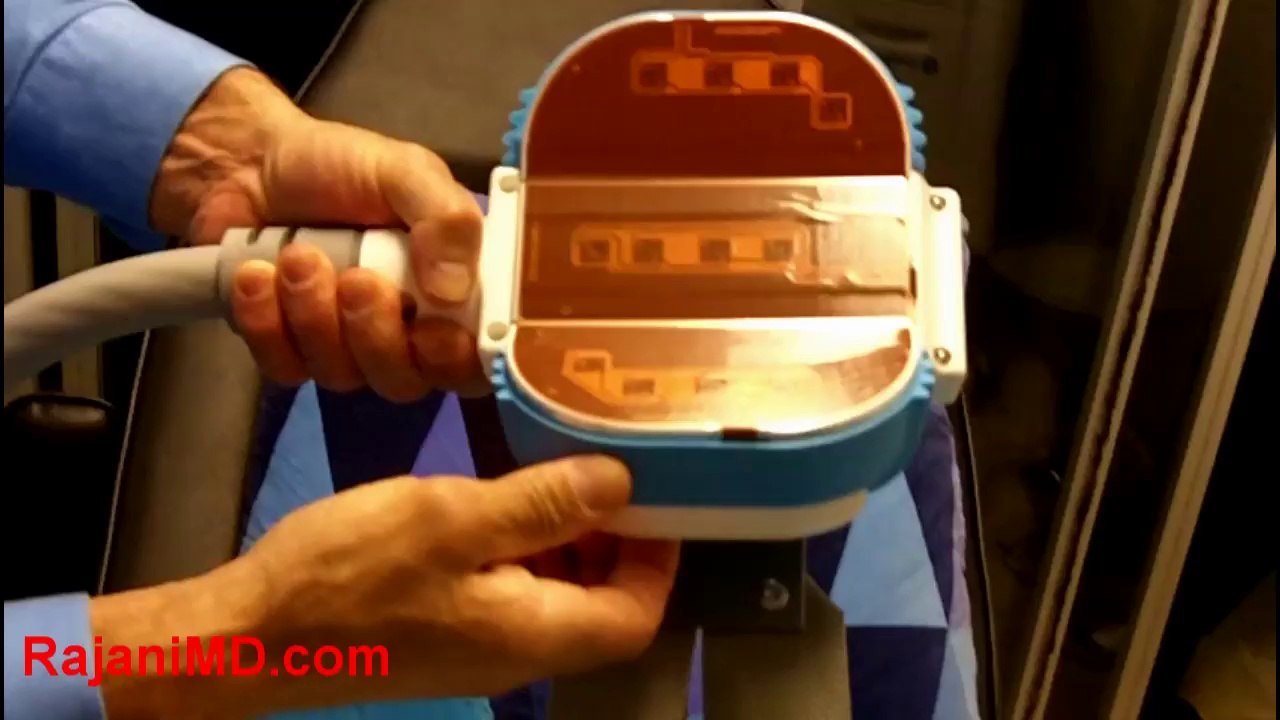 Coolsmooth Coolsculpting. Dr Rajani Shows the New Device