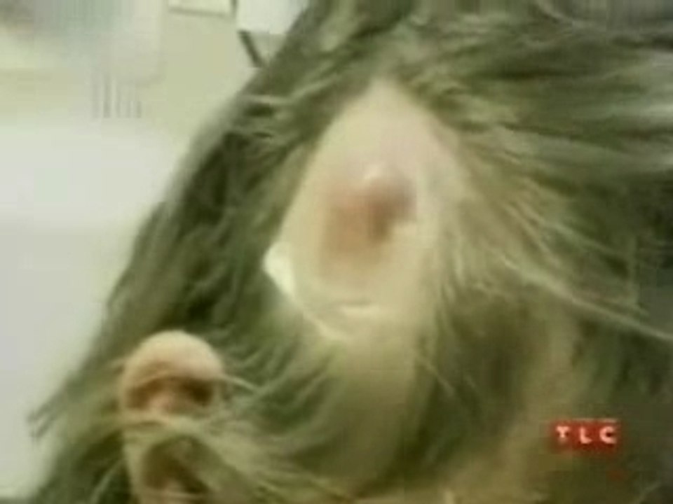 un insecte dans la tête