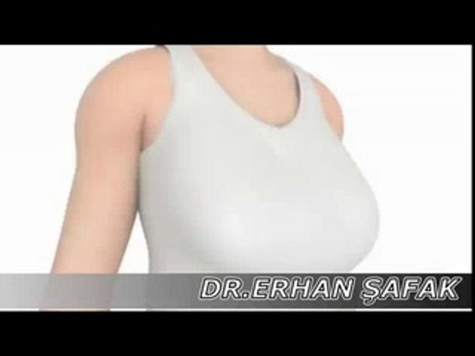 Meme Küçültme Bursa | Meme küçültme fiyatları
