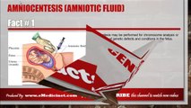 Information about Amniocentesis (Amniotic Fluid)