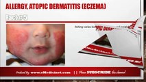 Information about Atopic Dermatitis (Eczema)