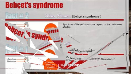 Information about Behçet's syndrome